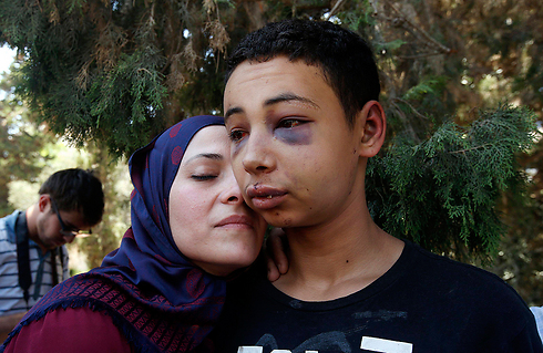 Tariq Abu Khdeir after being released from Israeli detention (Photo: Reuters)