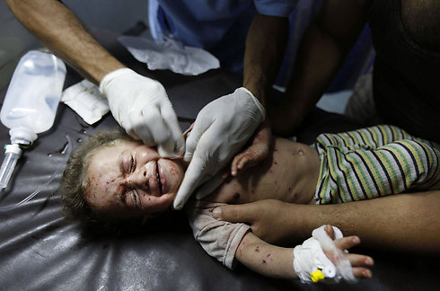 טיפול רפואי לילדה פלסטינית בבית החולים שיפא בעזה (צילום: AFP) (צילום: AFP)