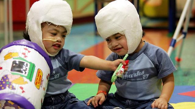 שרדו את הניתוח, אך נפגעו מוחית. האחים אגירה (צילום: AP) (צילום: AP)