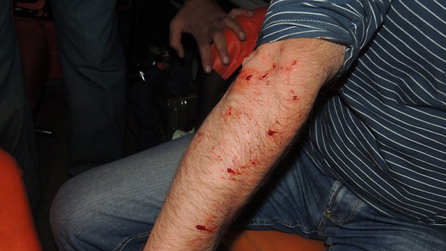 כתמי הדם על ידו של הפצוע (צילום: עומר רביע) (צילום: עומר רביע)