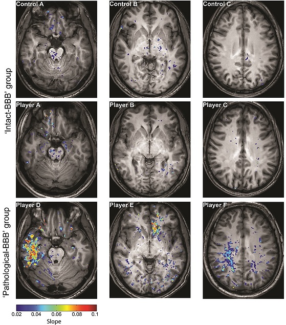 Photo: Courtesy of Ben Gurion University Photo: Courtesy of Ben Gurion University