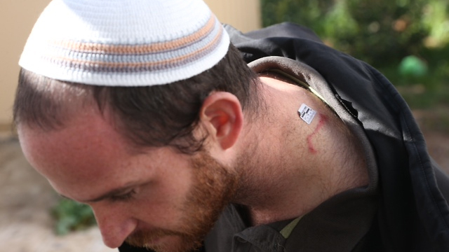 Josh Lorech sustained light wounds after being stabbed by female terrorist in West Bank. (Photo: Motti Kimchi) (Photo: Motti Kimchi)