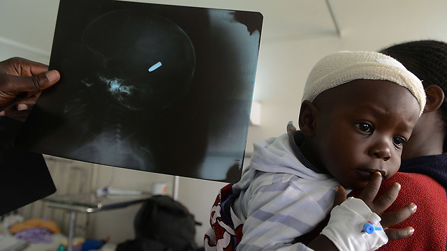 ילד פצוע בקניה, ולצדו צילום רנטגן המראה קליע בראשו. צילום: סימון מאינה (צילום: AFP) (צילום: AFP)
