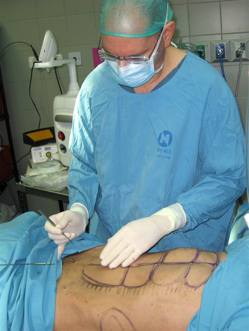 ד"ר פרידמן מסמן את הקוביות לפני תחילת הניתוח ( ) ( )