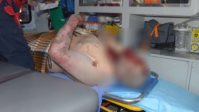 פצוע נוסף מפונה מבית החולים שבו אירע הפיצוץ (צילום: AFP) (צילום: AFP)