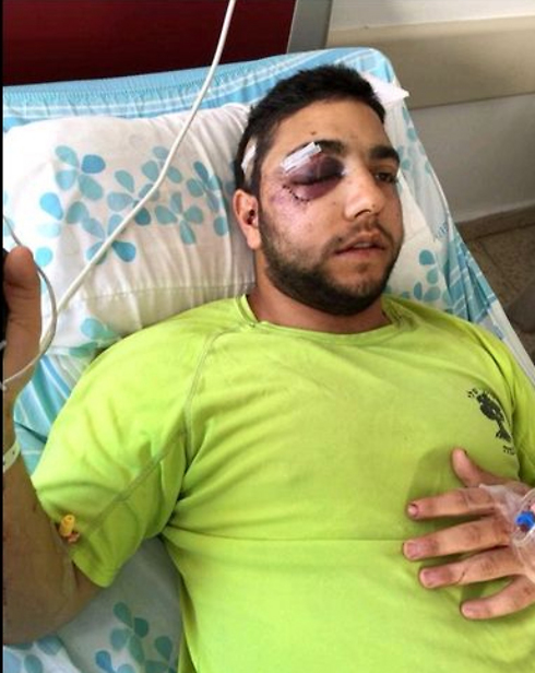 Razi Khasisi after attack