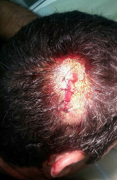 השוטר נפצע בראשו (צילום: דוברות חוף) (צילום: דוברות חוף)