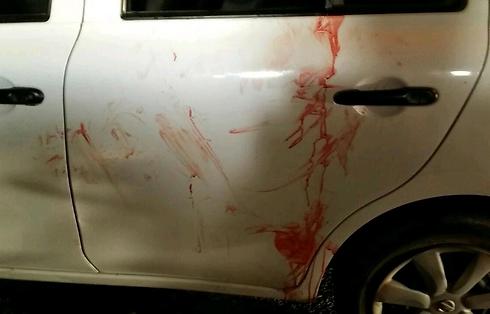 The bloodied vehicle Malachi and friends were in when they were attacked (Photo: TPS) (Photo: TPS)