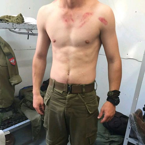 The soldier's self-inflicted injuries (Photo: Israeli Christians Recruitment Forum)