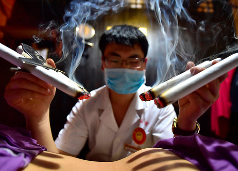 רופא סיני מטפל באדם באמצעות מקלות דמויי סיגר, שבתוכם תערובת מוקסה שמשמשת לחימום אזורים או נקודות בגוף (צילום: רויטרס) (צילום: רויטרס)