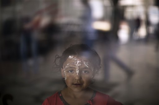 Syrian girl Rahaf Kaddour, 5, who was burnt in an explosion that hit her home, poses for a picture at MSF Hospital for Specialized Reconstructive Surgery in Amman, Jordan (Photo: AP)