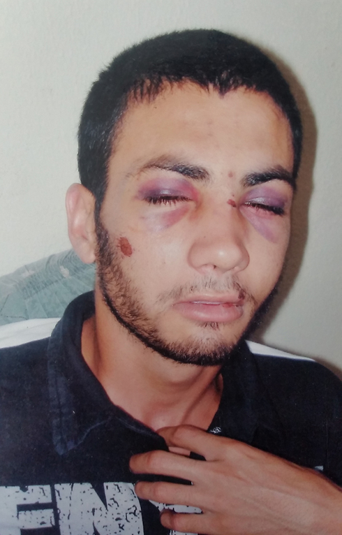 Abu Najma. Claims that since the incident he's suffered from hearing problems. (Photo: Eli Mendelbaum)