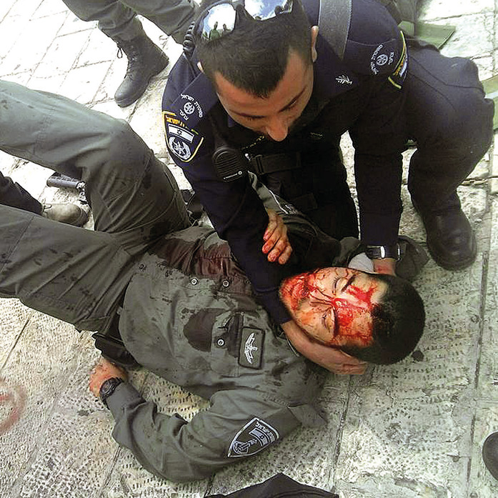 רגעים לאחר הפציעה הקשה בירושלים | צילום: נריה אברהם