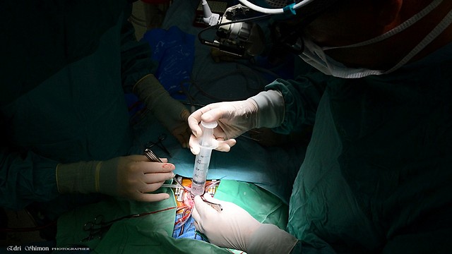 Doctor performs heart surgery on a child (Photo: Shimon Adri)