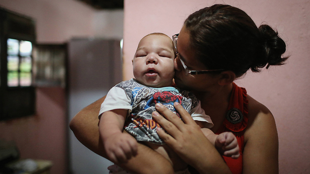 תינוק הסובל ממיקרוצפליה בעיר רסיפה (צילום: Gettyimages) (צילום: Gettyimages)