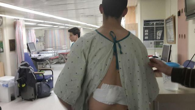 The teen with dressings over his back where he was stabbed
