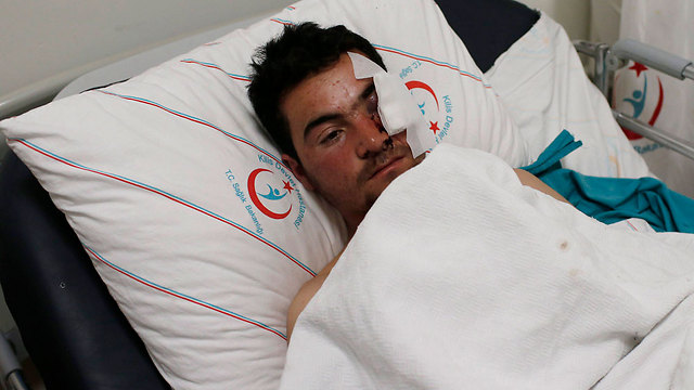 מורד סורי פצוע בקיליס, טורקיה (צילום: EPA) (צילום: EPA)