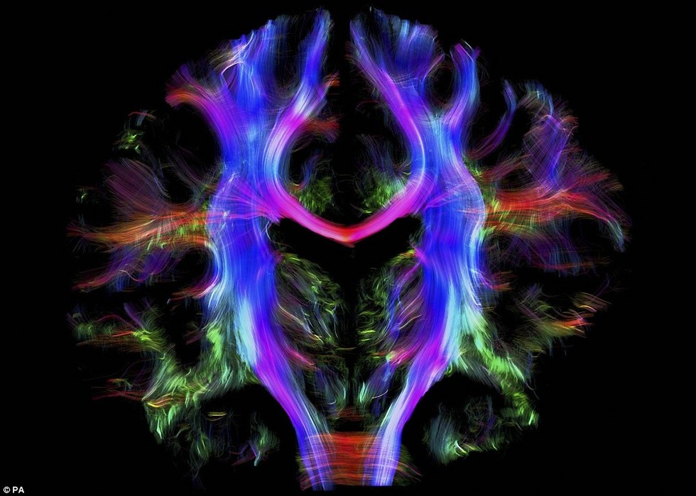 חיווט סיבי העצב במוח (צילום: PA) (צילום: PA)