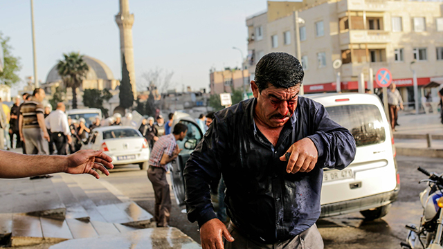 שדרות של טורקיה. פצוע טורקי בעיר קיליס הגובלת עם סוריה (צילום: AFP) (צילום: AFP)
