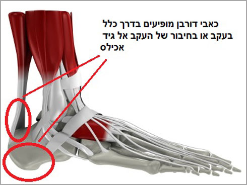 כדי לאבחן דורבן על המטופל לעבור בדיקת גופנית של נקודות רגישות בכף הרגל