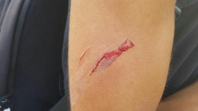 Injury sustained by one of the Israeli teens