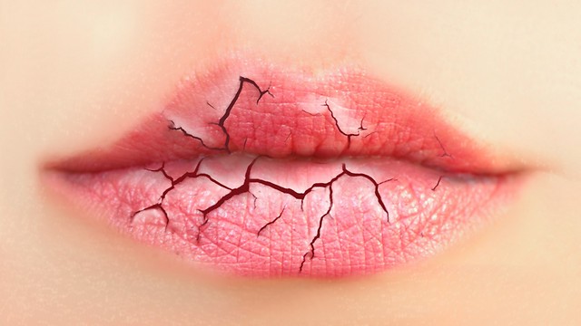 הורמונים עלולים לגרום ליובש בפה (צילום: shutterstock) (צילום: shutterstock)