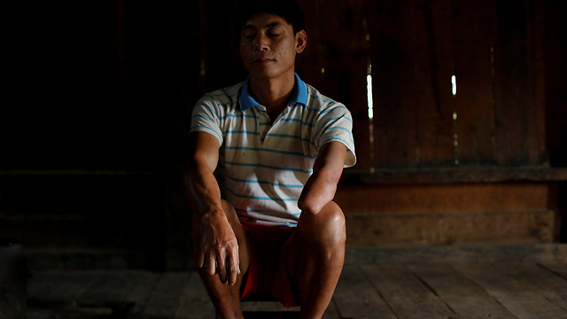 איבד בגיל עשר את ראייתו וידו מפצצת נפל. סוד, בן 40  (צילום: רויטרס) (צילום: רויטרס)
