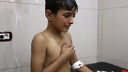 A wounded boy from the chlorine gas attack in Aleppo