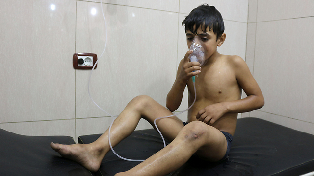 A wounded boy from the chlorine gas attack in Aleppo (Photo: AFP)