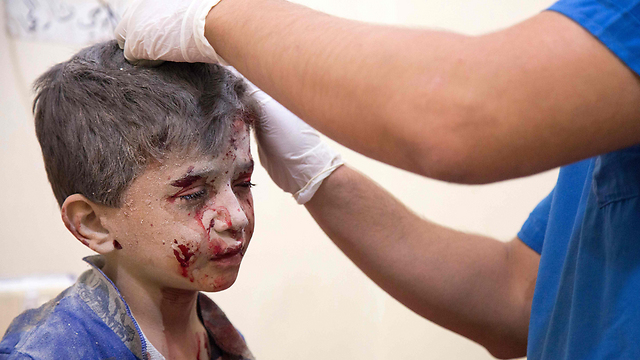 ילד בבית החולים בחלב. אחיו התינוק נהרג בהפגזה (צילום: AFP) (צילום: AFP)