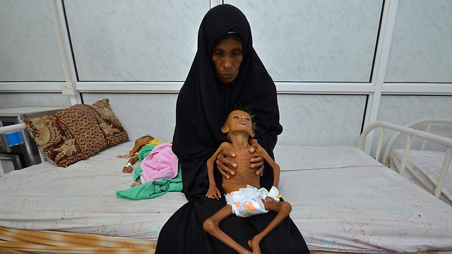 המשבר ההומניטרי הקשה בעולם. תימן (צילום: רויטרס) (צילום: רויטרס)