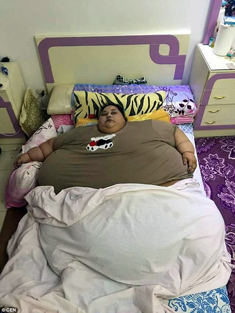אימאן אחמד עבדולאטי לפני הניתוח. מרותקת למיטתה ()
