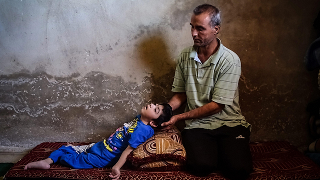 אחמד, אזרח סורי, מטפל בבתו שהפכה נכה בגלל הפגזות צבא אסד (צילום: EPA) (צילום: EPA)