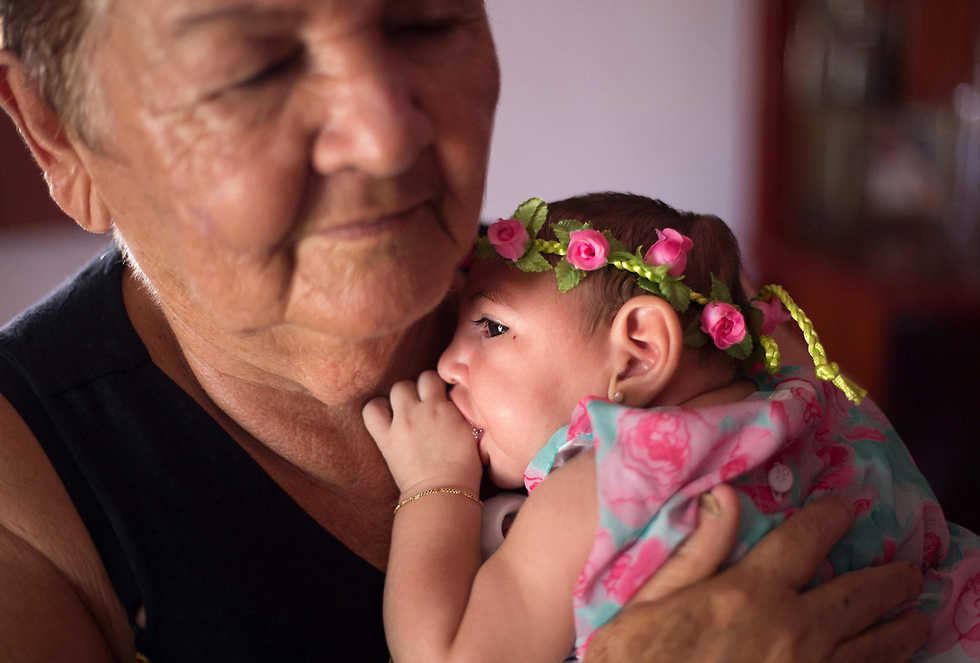 אנה באטריז, תינוקת ברזילאית שנולדה עם מיקרוצפליה (תופעה שבה תינוקות נולדים עם ראש קטן ונזק מוחי קשה), כנראה בגלל פגיעת נגיף הזיקה (צילום: EPA) (צילום: EPA)
