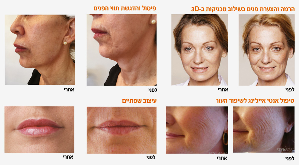 לשימוש הכתבה בלבד שוש רוטנברג הילה איסקוב