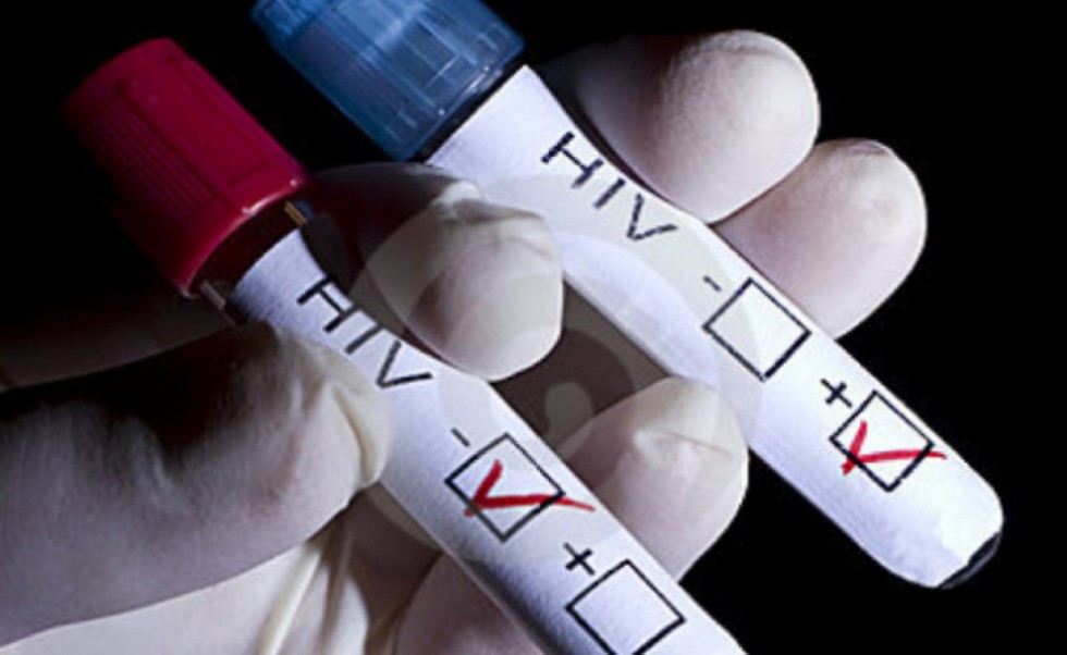 בדיקת דם פשוטה ל-HIV ( ) ( )