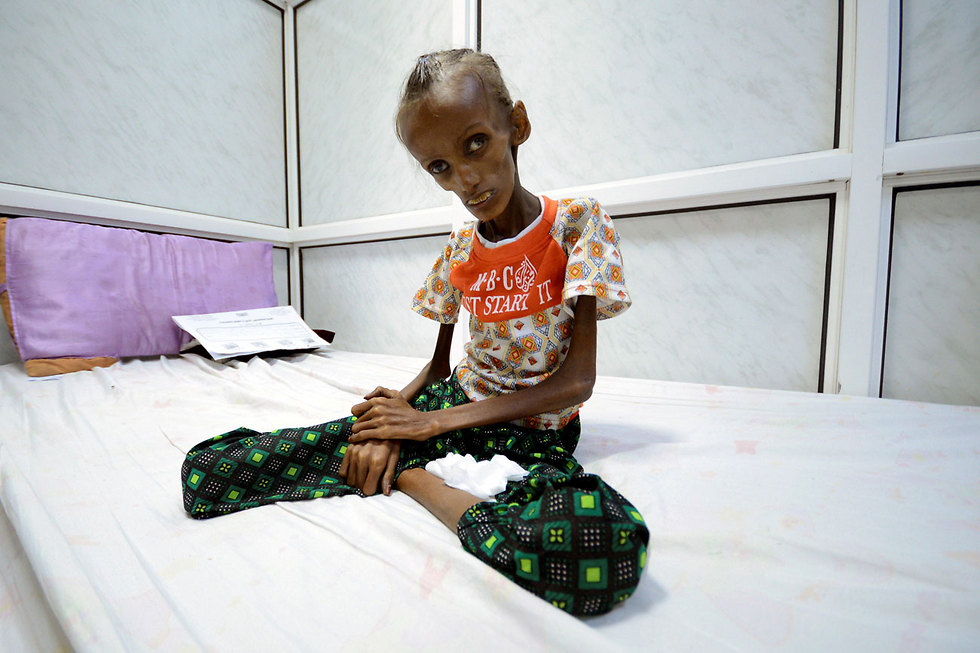 starvation in Yemen (Photo: Reuters)