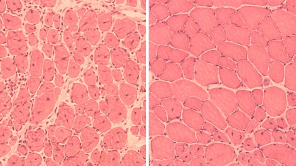 משמאל - תאי שריר מעכבר מזדקן. מימין - תאי שריר מעכבר מזדקן שעבר "תכנות מחדש" (צילום: מכון סאלק) ( ) ( )