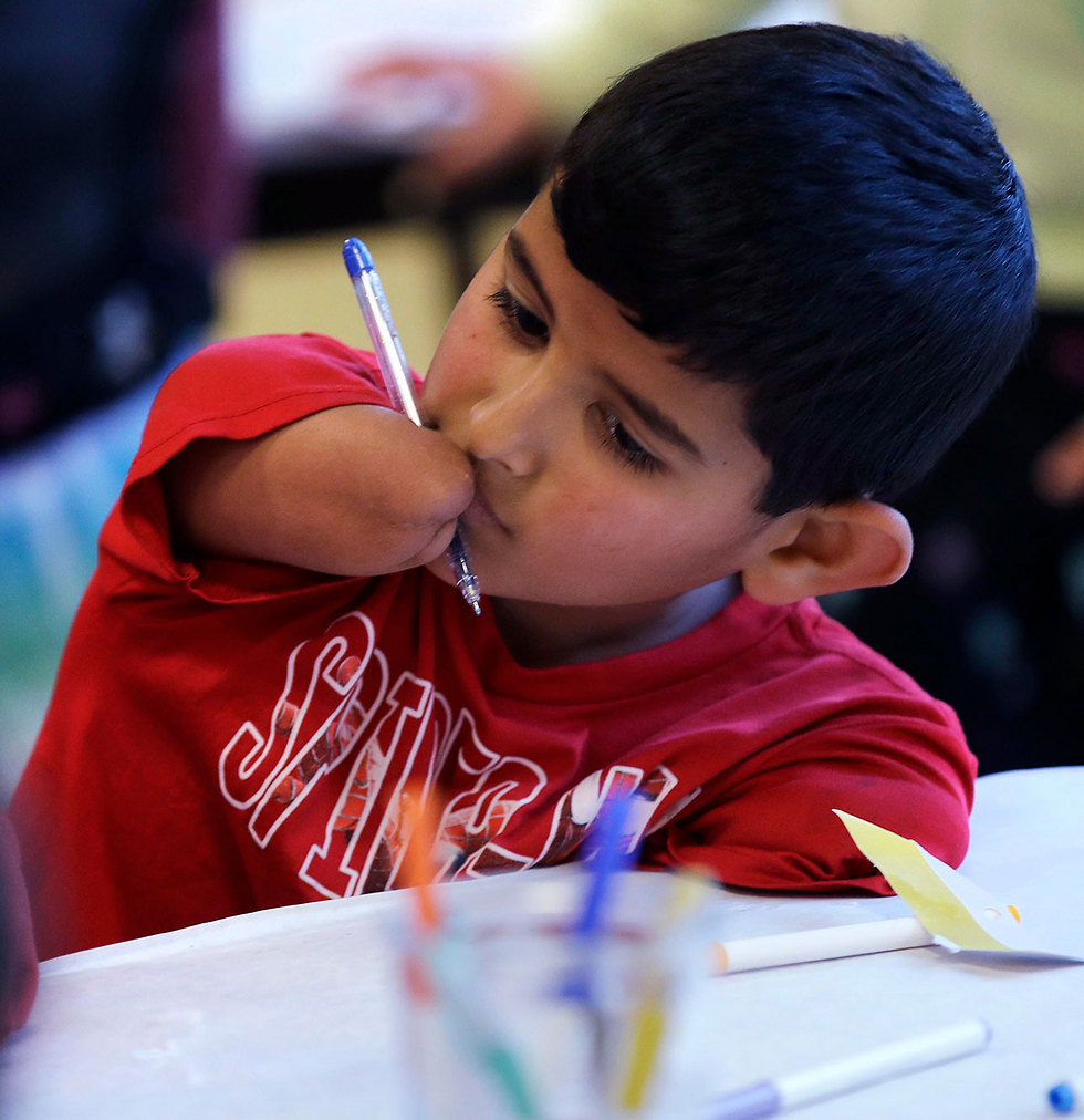 Сирийский мальчик Ахмед аль-Халаф, потерявший руки во время бомбежек, эмигрировал в США. Фото: AP
