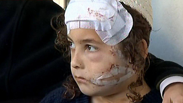 Natan Atia, days after the incident (Photo: Channel 2)