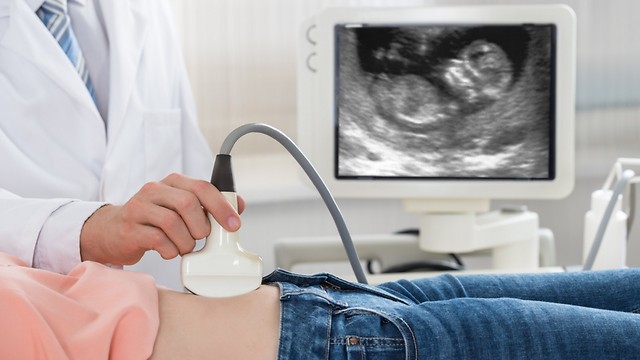לשמור על בריאות העובר. בדיקת אולטראסאונד בהיריון (צילום: shutterstock) (צילום: shutterstock)