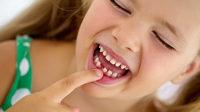 בערך בגיל 3, לכל ילד אמור להיות סט שלם של 20 שיני חלב (צילום shutterstock) (צילום shutterstock)