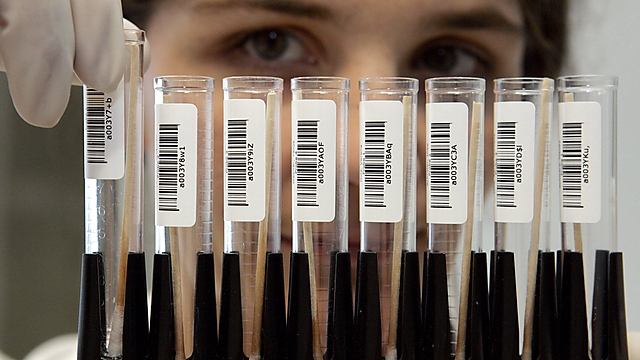 DNA tests (Photo: EPA)