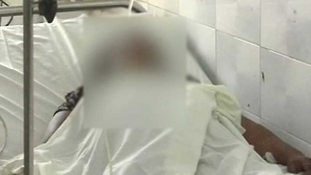 הותקפה בחומצה חמש פעמים. האישה המותקפת בבית החולים (צילו: רויטרס) (צילו: רויטרס)