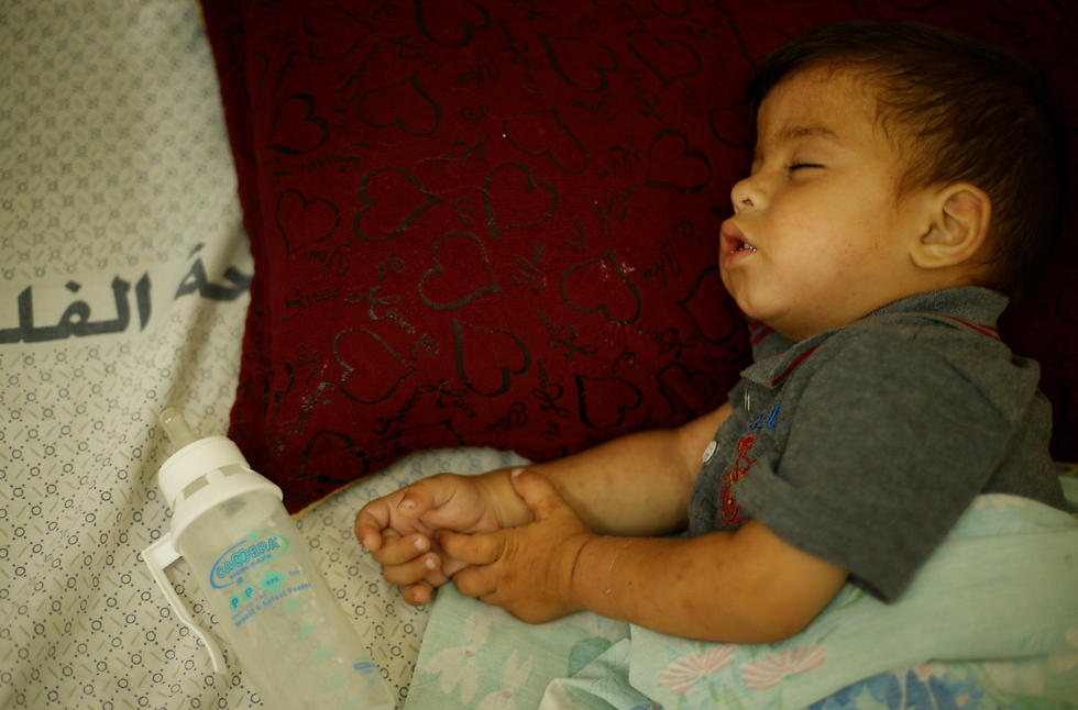 Ahmed Abbas, who suffers from cystic fibrosis, sleeps as he lies on a hospital bed in Gaza City (Photo: Reuters)