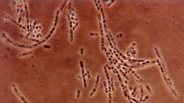 חיידקים קוטלי זחלים של מזיקי חקלאות (צילום: פרופ' אילן בן-דוב) (צילום: פרופ' אילן בן-דוב)