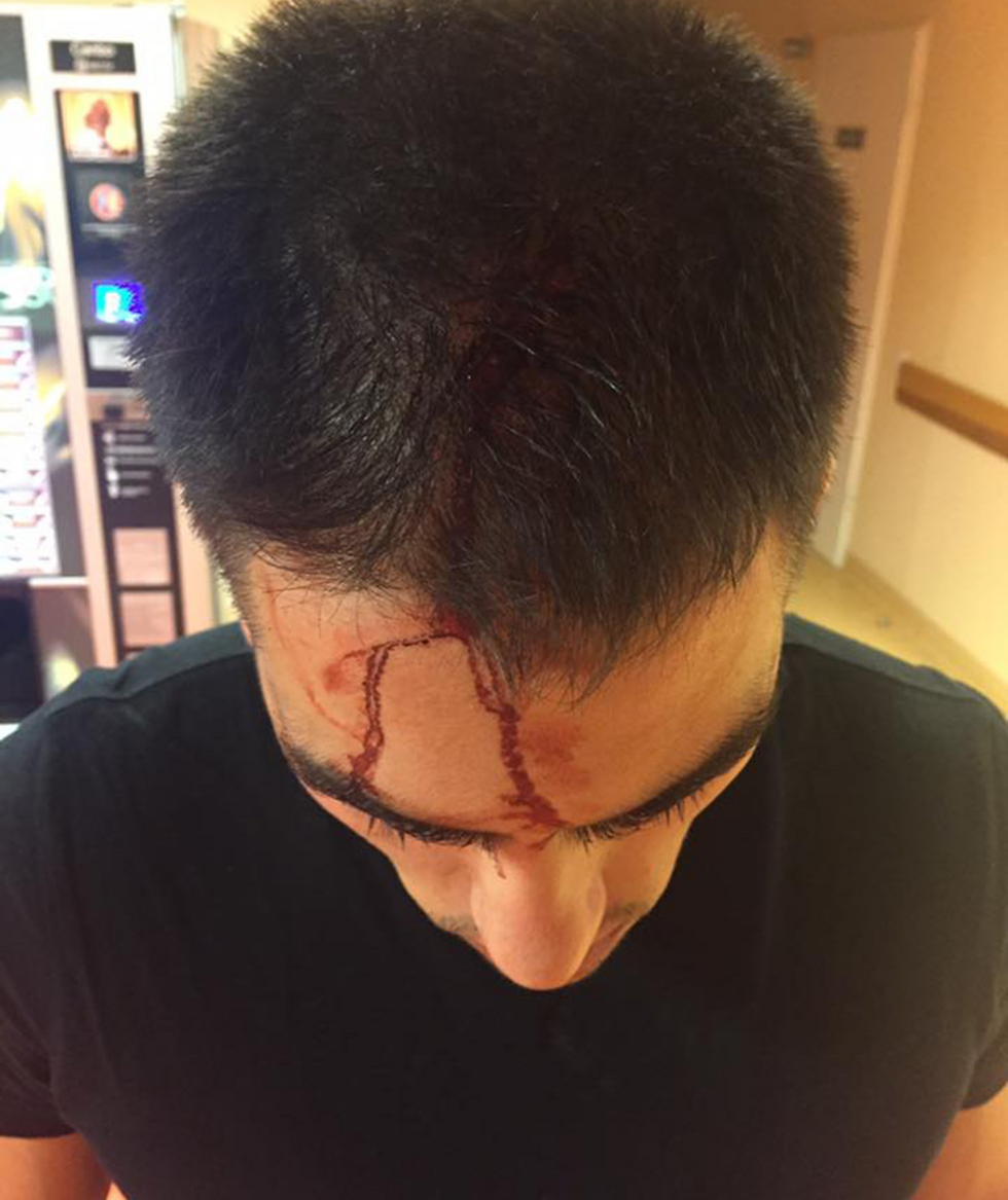 Cohen was attacked by an Egyptian man in a bar (Photo: Eli Cohen) (Photo: Eli Cohen)