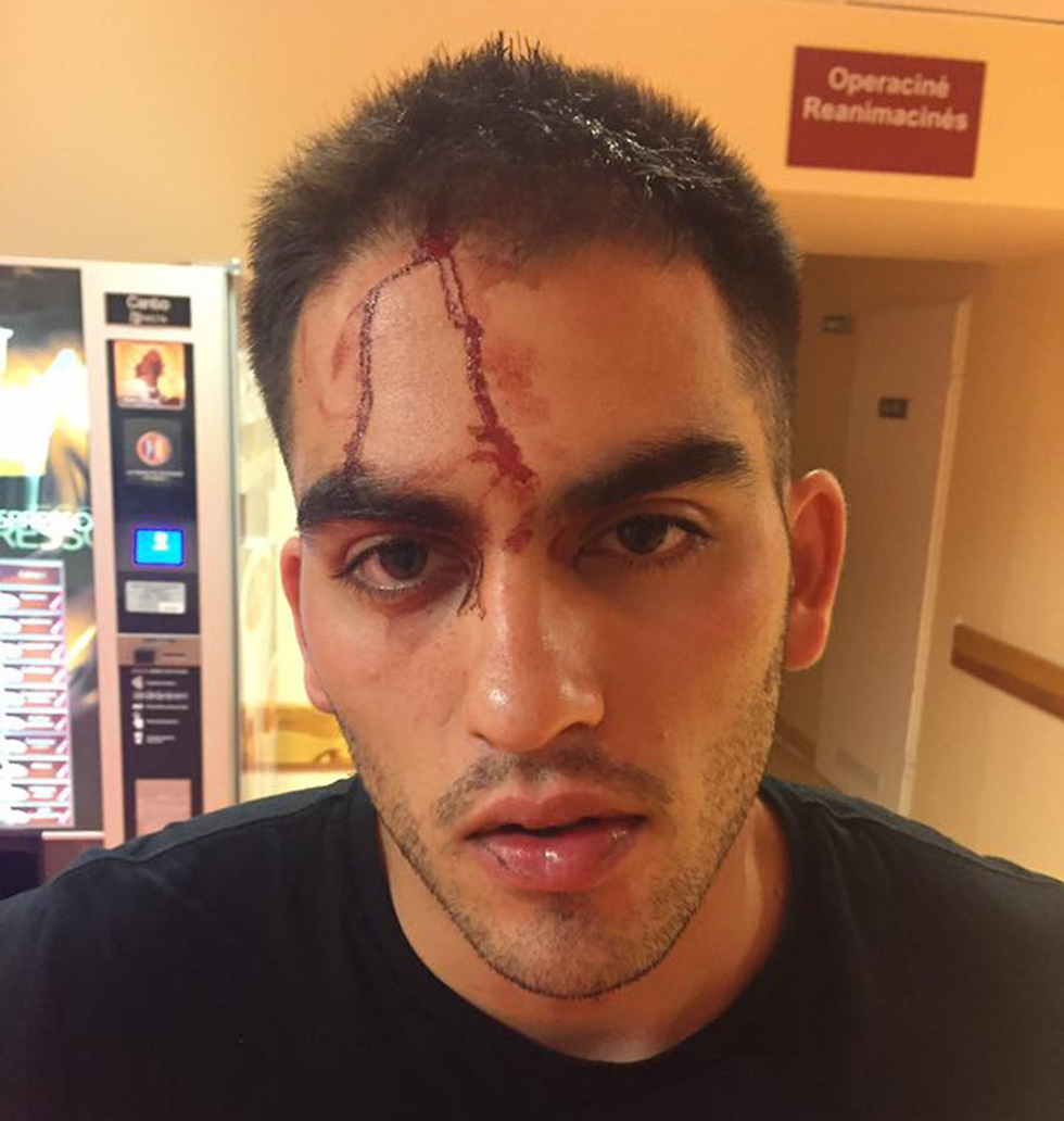 Student Eli Cohen showing the aftermath of the anti-Semitic attack (Photo: Eli Cohen) (Photo: Eli Cohen)