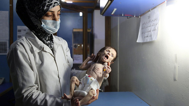 תמונתה של התינוקת בת החודש מע'וטה שהסעירה את העולם (צילום: AFP) (צילום: AFP)