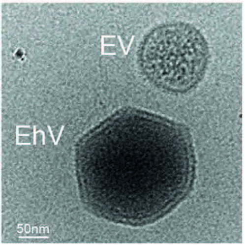הווירוס (EhV) והבועית (EV) במיקרוסקופ אלקטרונים קריוגני (צילום: אתר מכון ויצמן למדע)